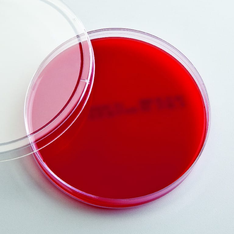 Ward's® Prepared Columbia CNA Agar