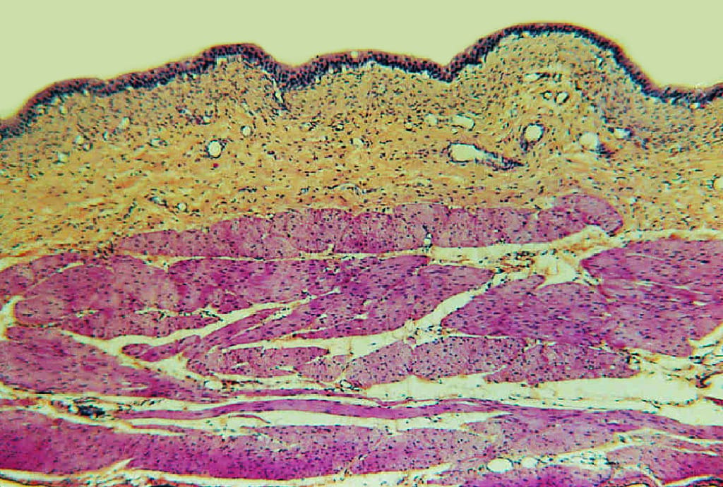Urinary Bladder, Distended Slide