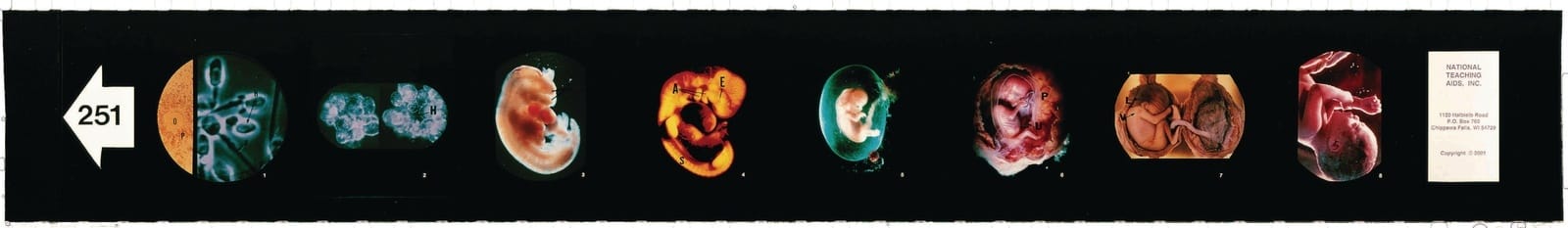 Human Fetal Development Microslides