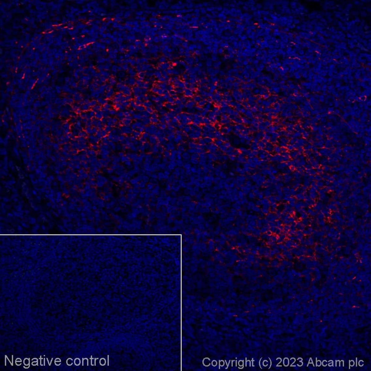 Anti-CXCL13 Rabbit Monoclonal Antibody [clone: EPR23400-92] (Alexa ...