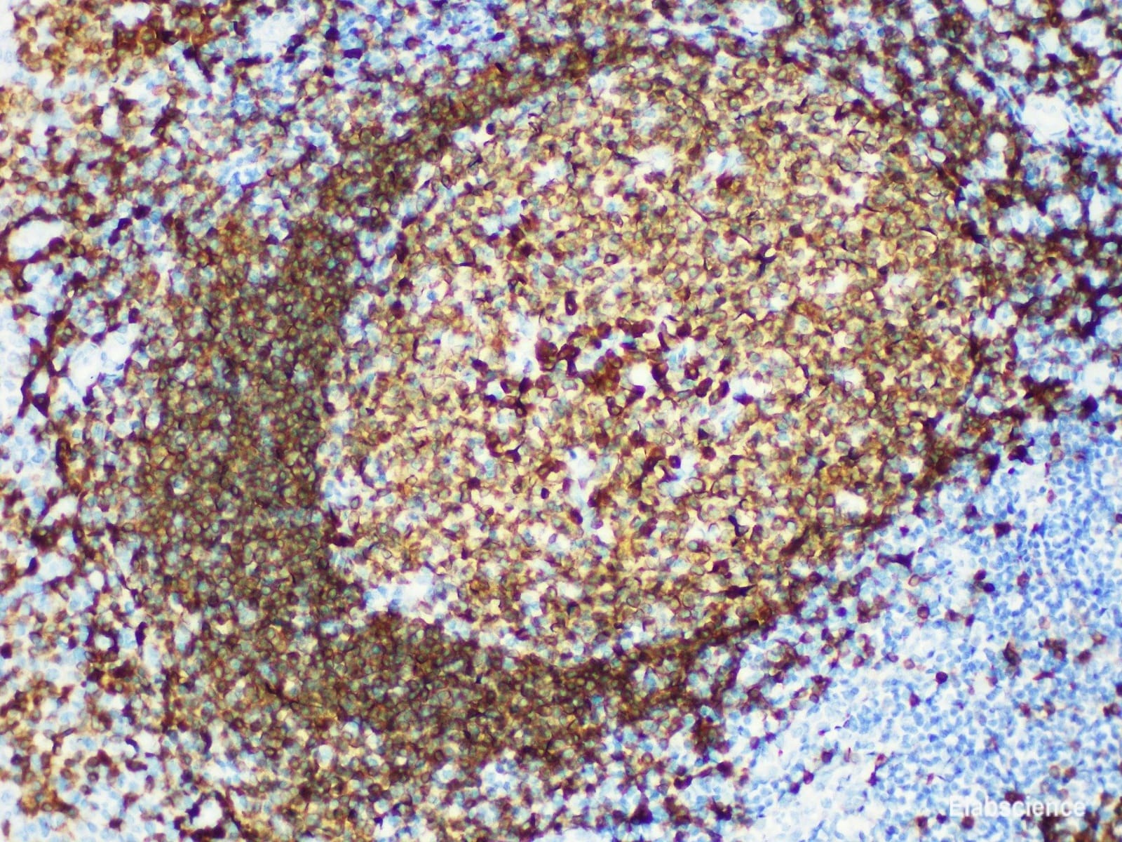 Anti-CD79a Rabbit Monoclonal Antibody [clone: YN00435r] | VWR, part of ...