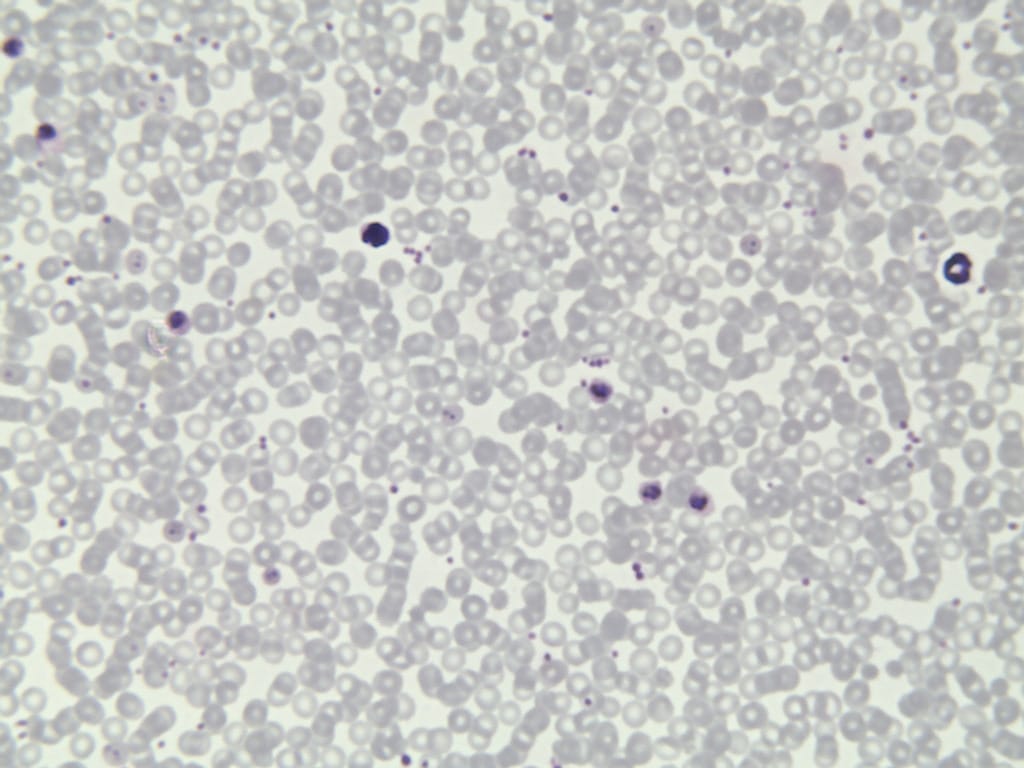 Plasmodium cynomolgi Slide
