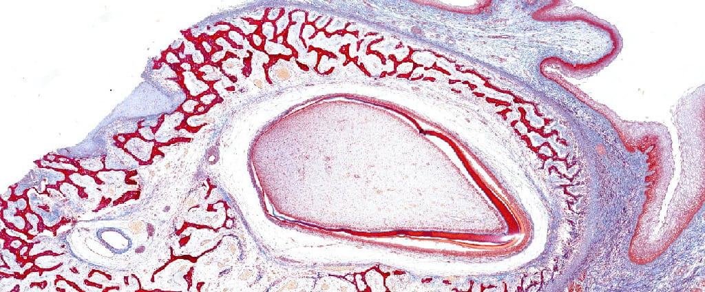 Tooth Development Slides