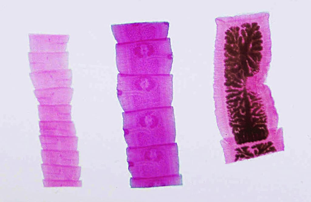 Taenia Pisiformis, Cat/Dog Tapeworm, Composite Slide