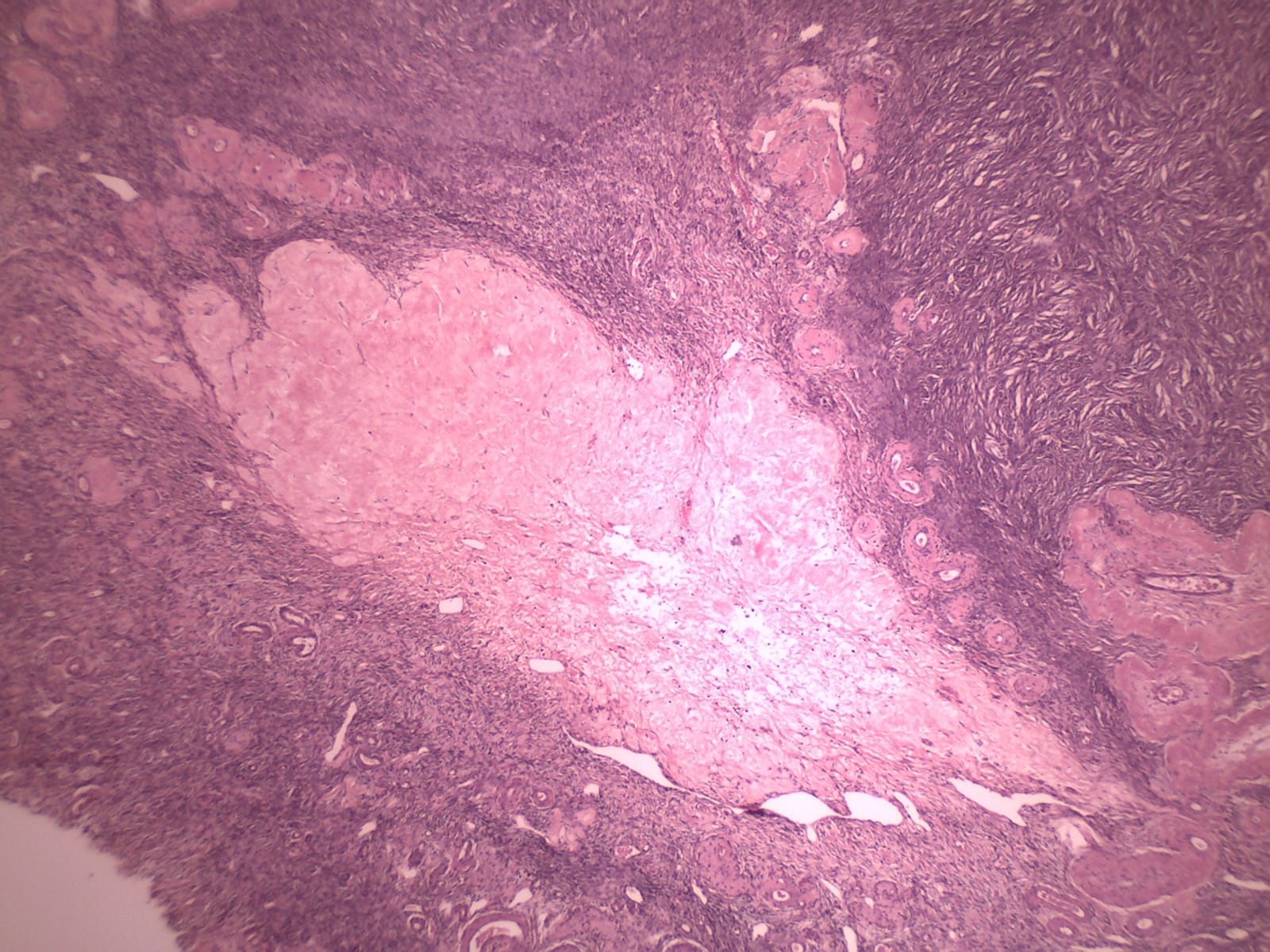 Ovary, Corpus Albicans, Human Slide