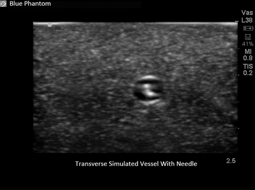 Blue Phantom® Ultrasound Training Block Models