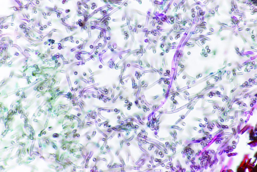 Ectotrophic Mycorrhiza Slide