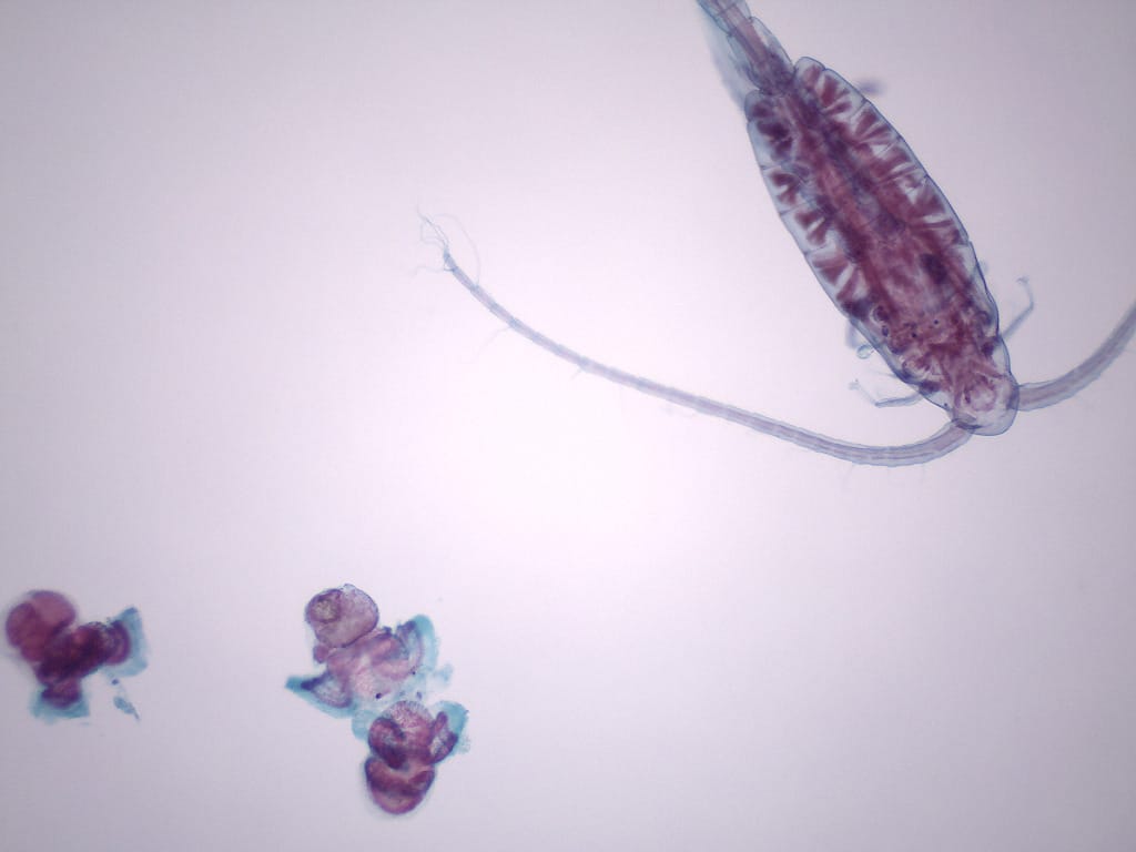Marine Zooplankton Slide