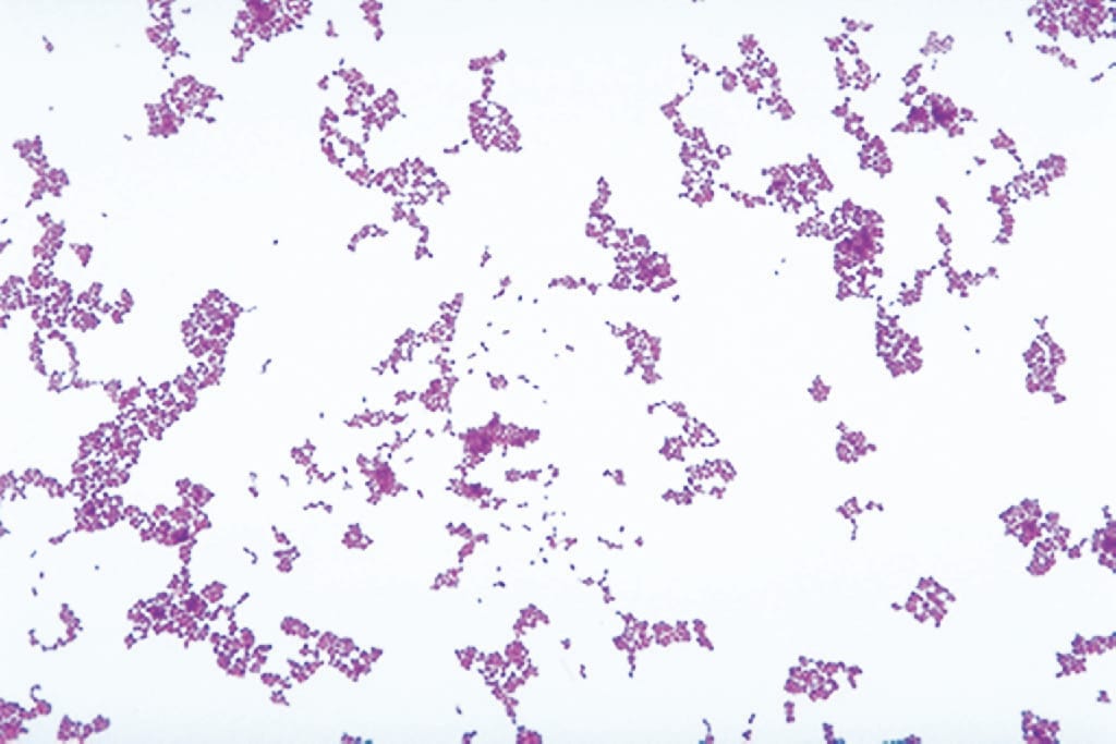 Ward's® Live Lactococcus lactis Culture