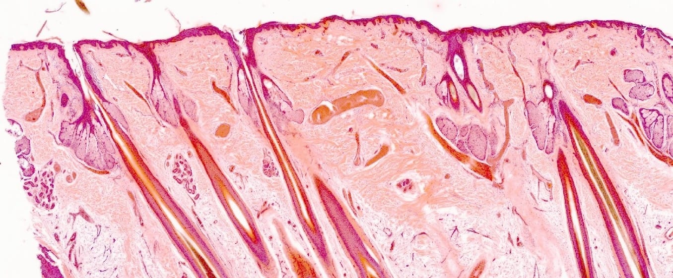 Adult Scalp, Unpigmented Slide