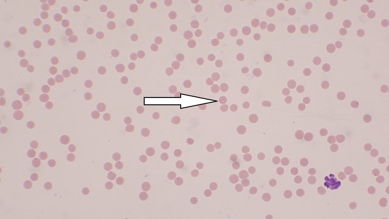 Anaplasma Marginale Slide
