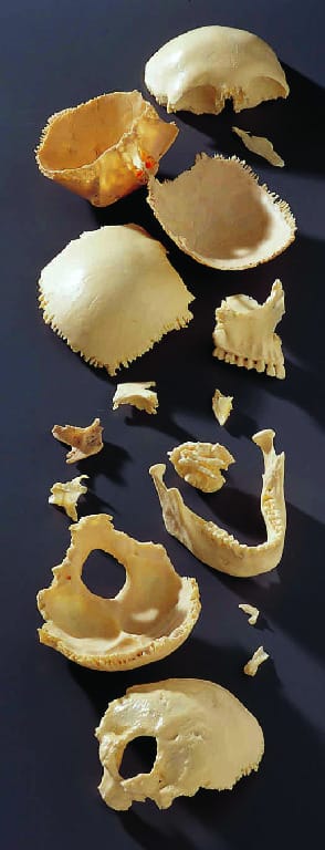 Somso® Individual Human Bones