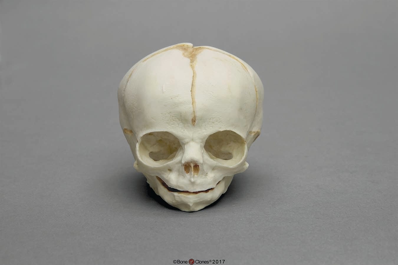 BoneClones® Fetal Skull Set