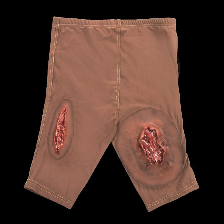 STOPS® Wound Clothing