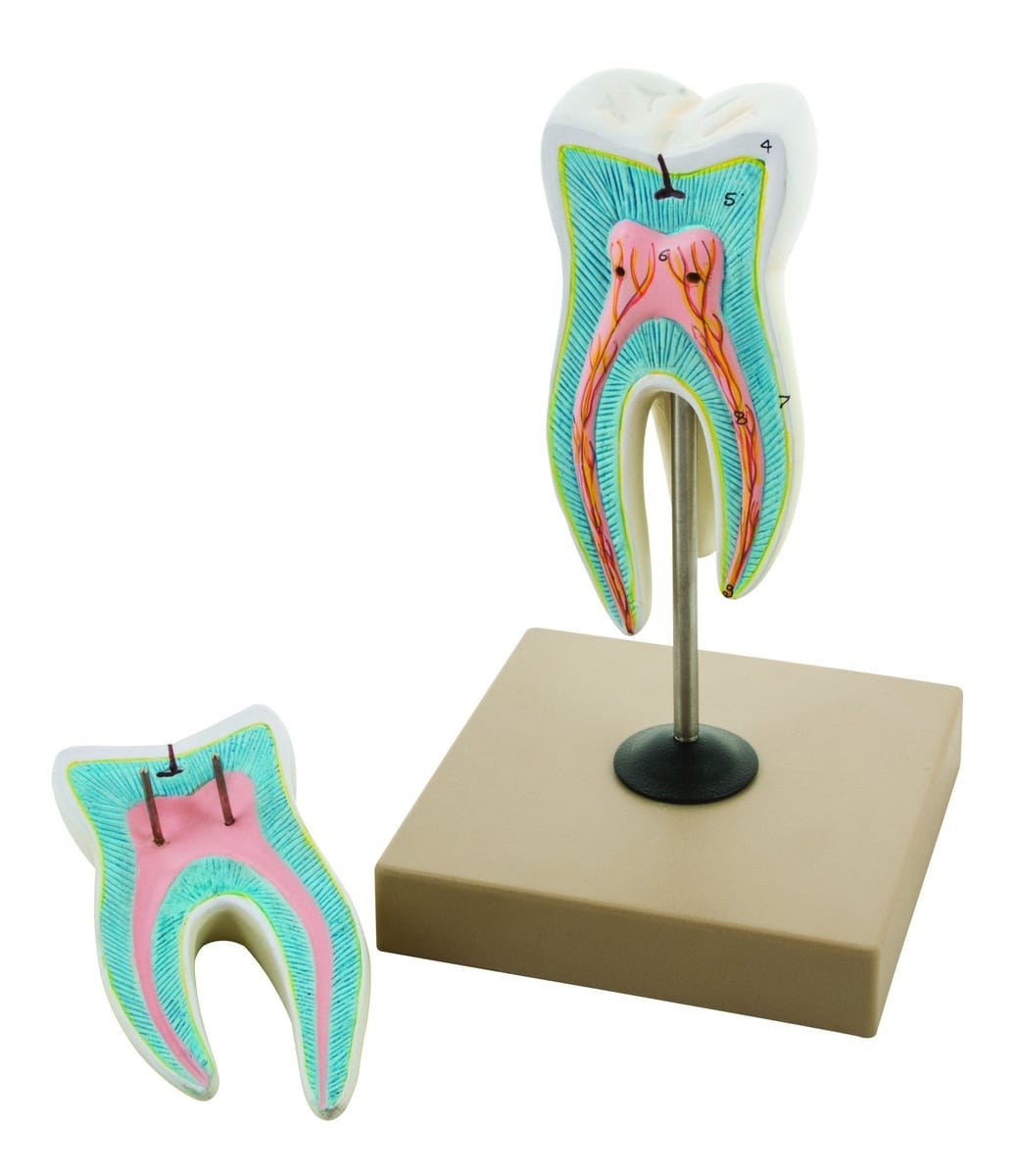 Eisco® Enlarged Upper Triple Root Molar, 2 Parts