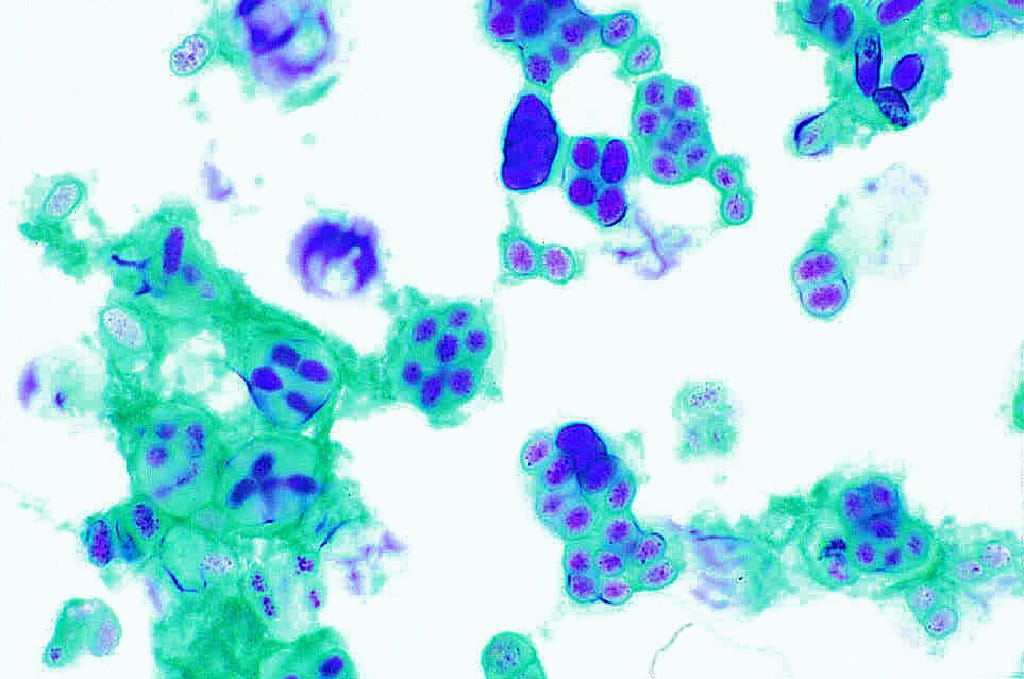 Gloeocapsa Slide