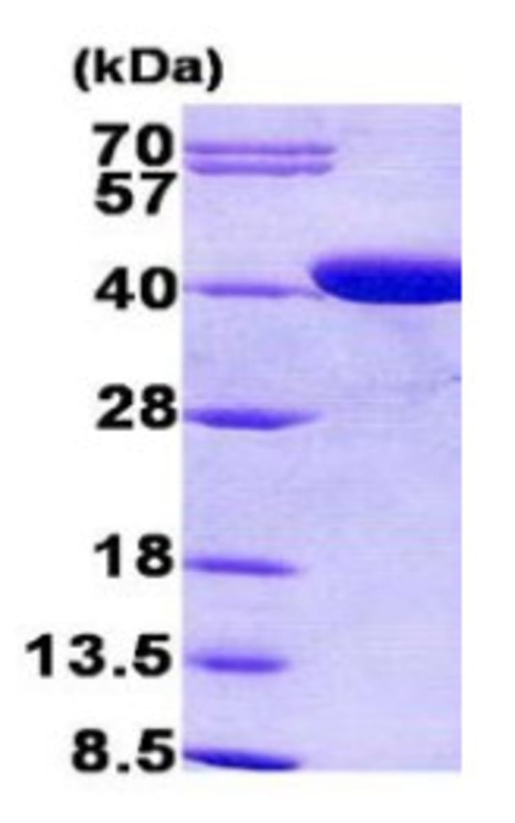 Human Recombinant CPOX (from E. coli) | VWR, part of Avantor