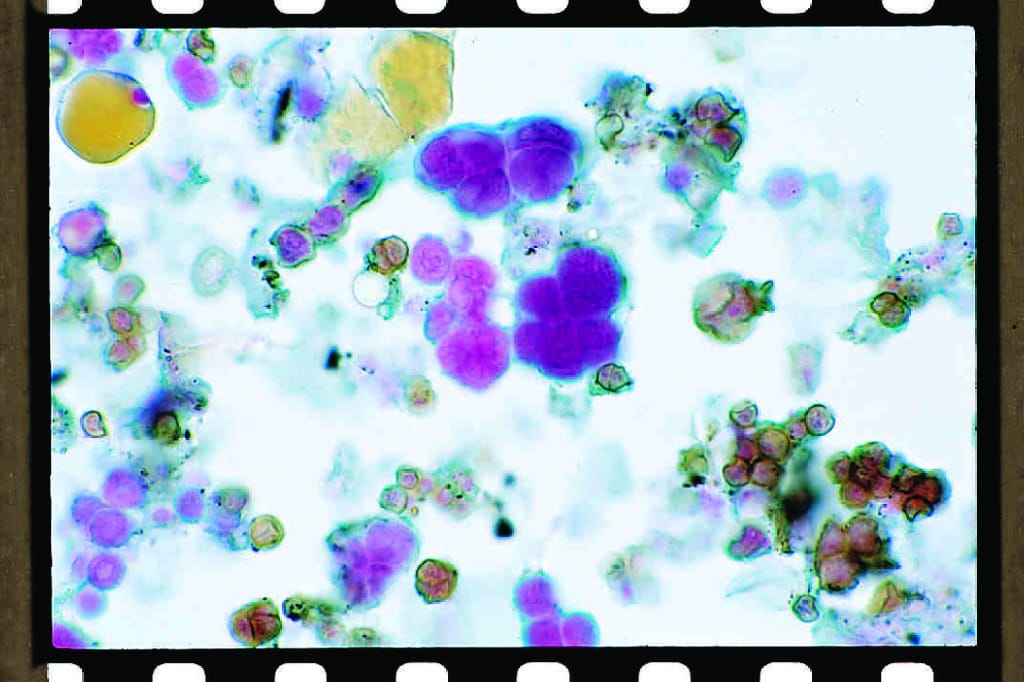 Protococcus, Pleurococcus, Whole Mount Slides