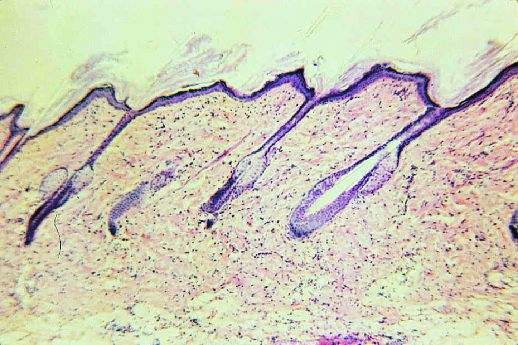 Skin of Hairy Mammal Slide