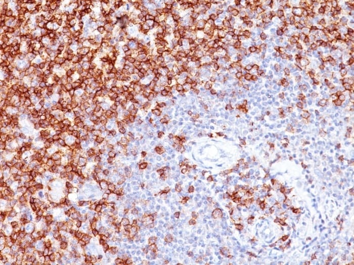 Anti-CD45RO Mouse Monoclonal Antibody [clone: UCHL-1] | VWR, part of ...