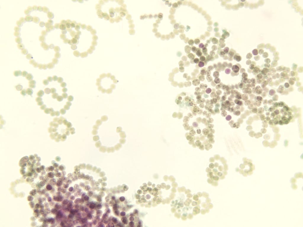 Anabaena Slide