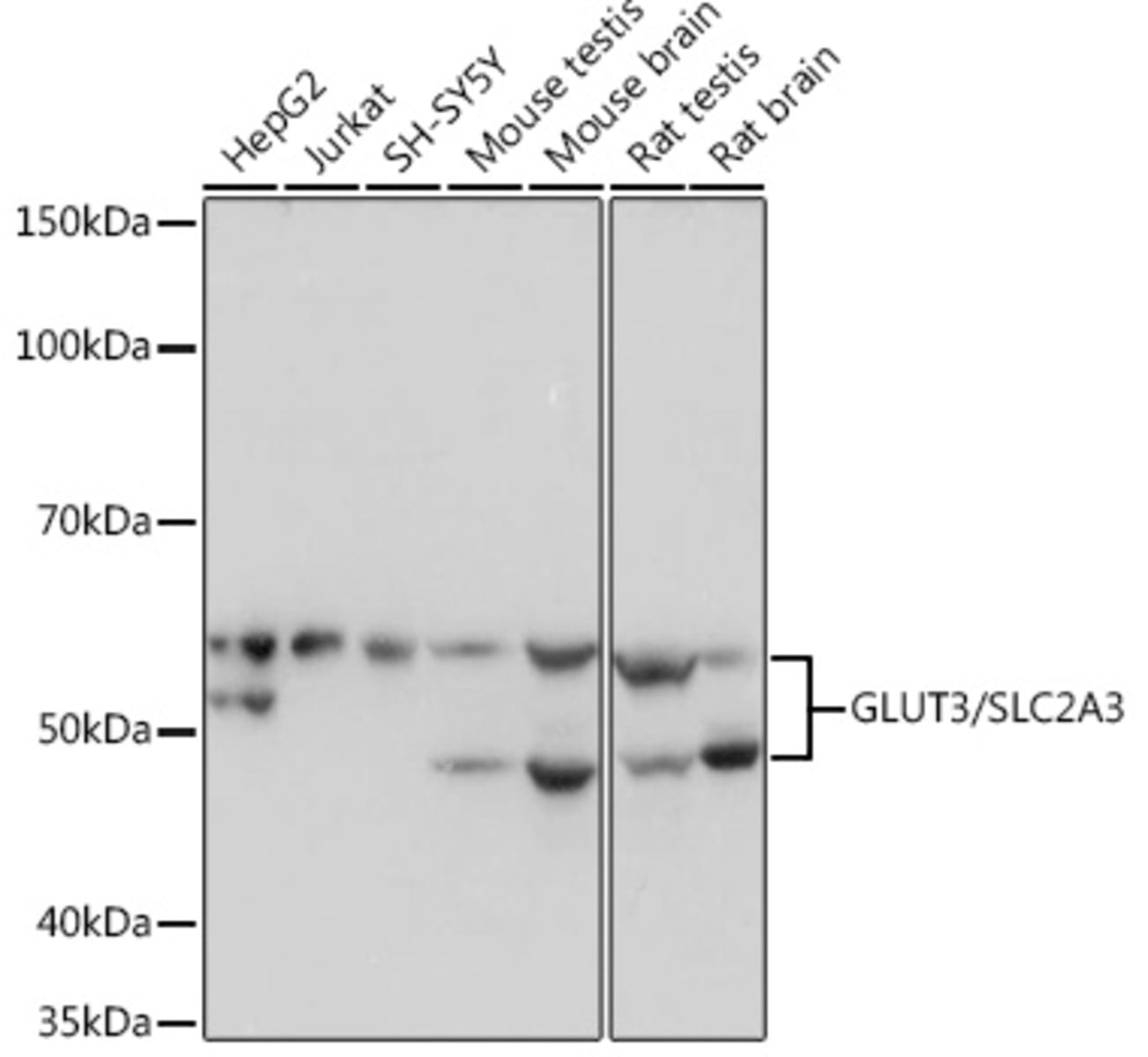 Anti-Glucose Transporter GLUT3 Rabbit Monoclonal Antibody [clone ...