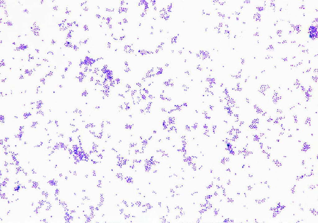 Streptococcus pneumoniae Slide