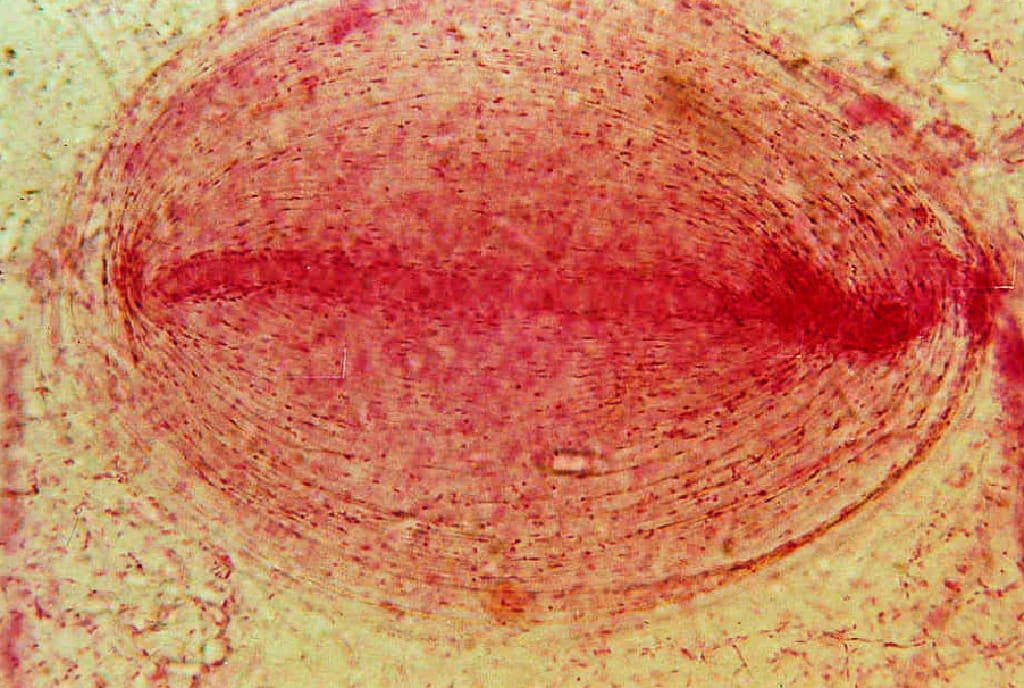 Pacinian Corpuscle Slide