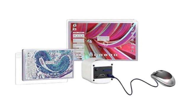 Accu-Scope Excelis HD Color Camera with Tablet
