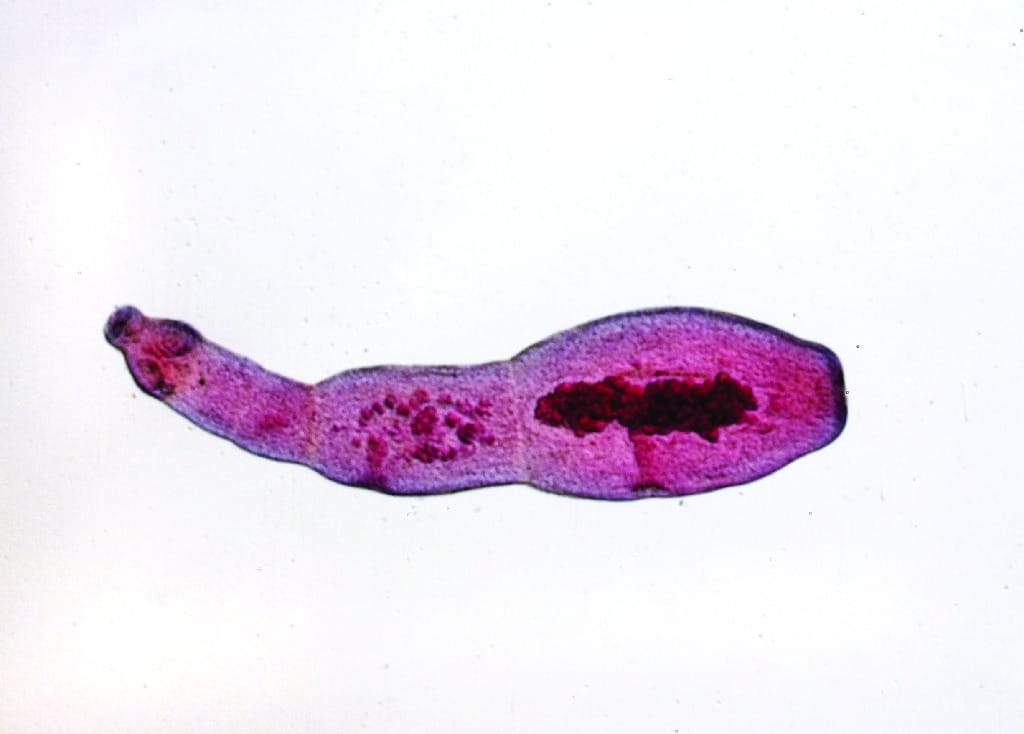 Echinococcus granulosus Slide