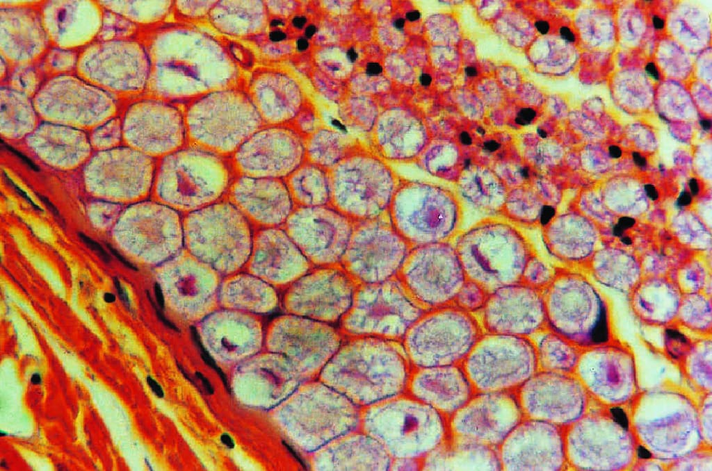 Nervous Tissue, Peripheral Nerve Slide