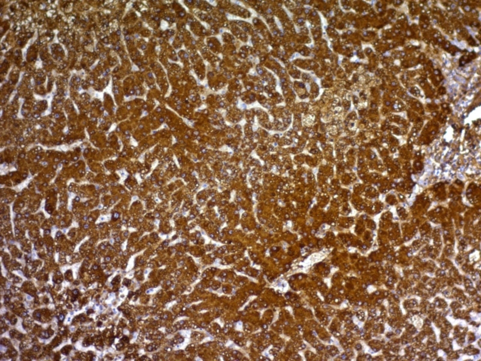Anti-Glypican 3 Mouse Monoclonal Antibody [clone: GPC3/863] | VWR, part ...