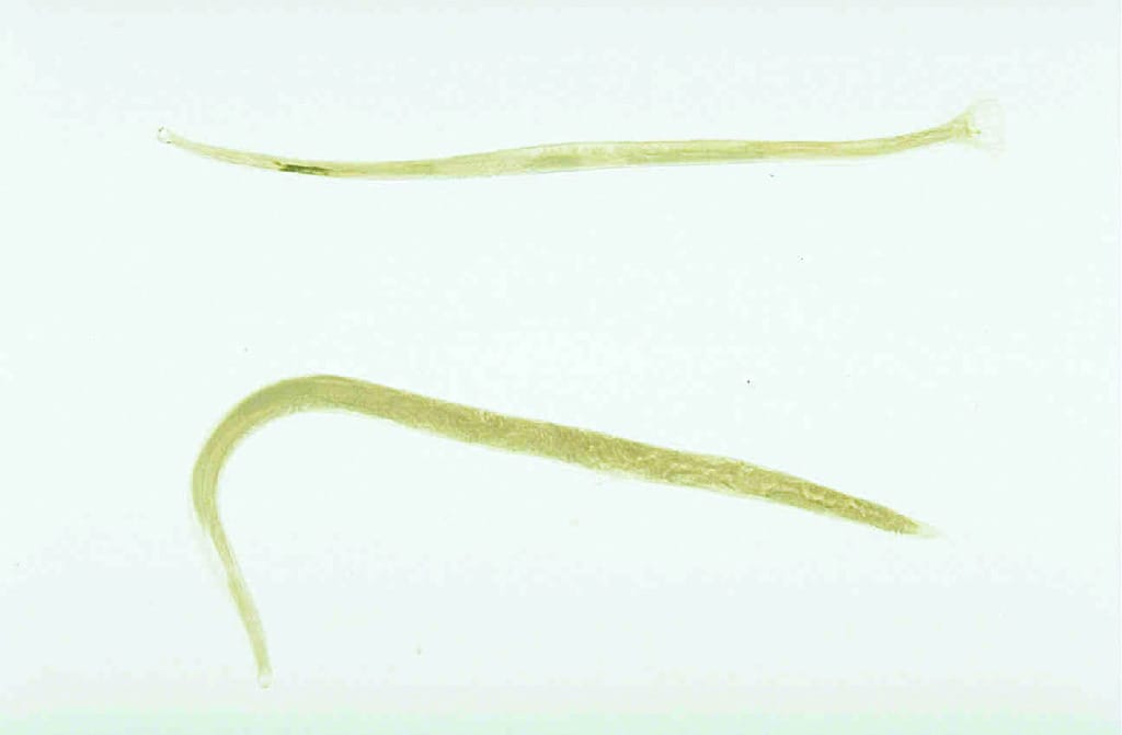 Ancylostoma sp., Male/Female, Slide