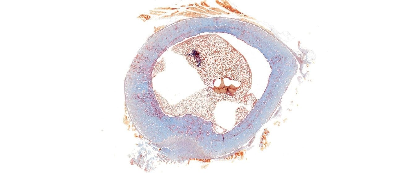 Bone Development Slide
