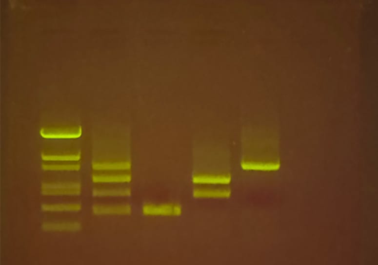 Edvotek® Tick Talk: Tick-Borne Disease Diagnostics
