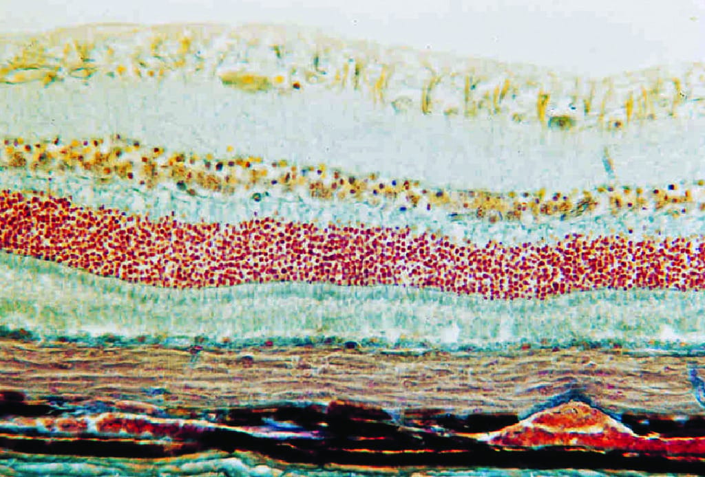 Retina Slide