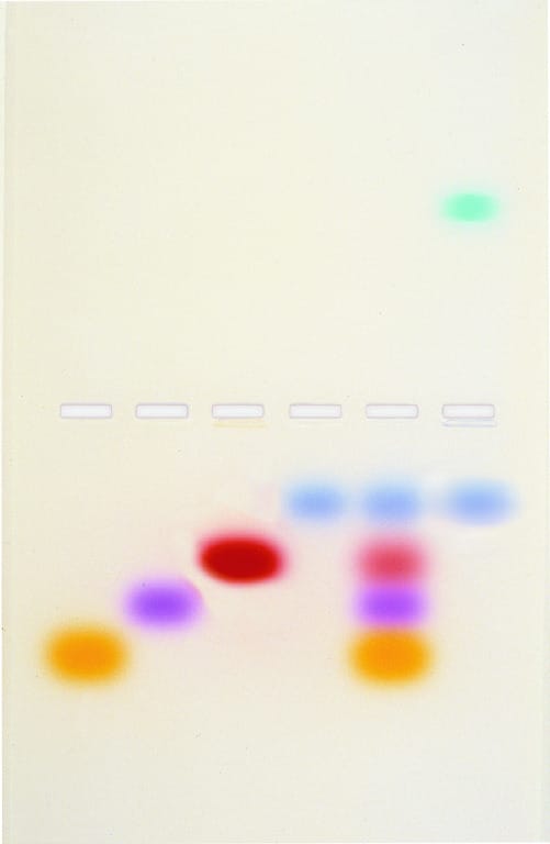 Principles and Practice of Agarose Gel Electrophoresis Kit