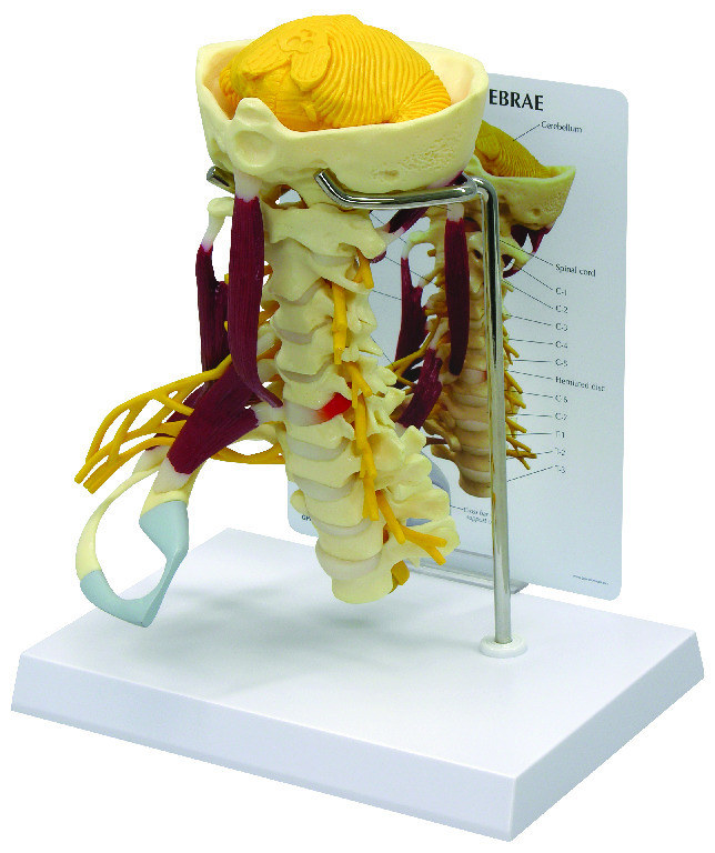 GPI Anatomicals® Muscled Cervical Spine Model
