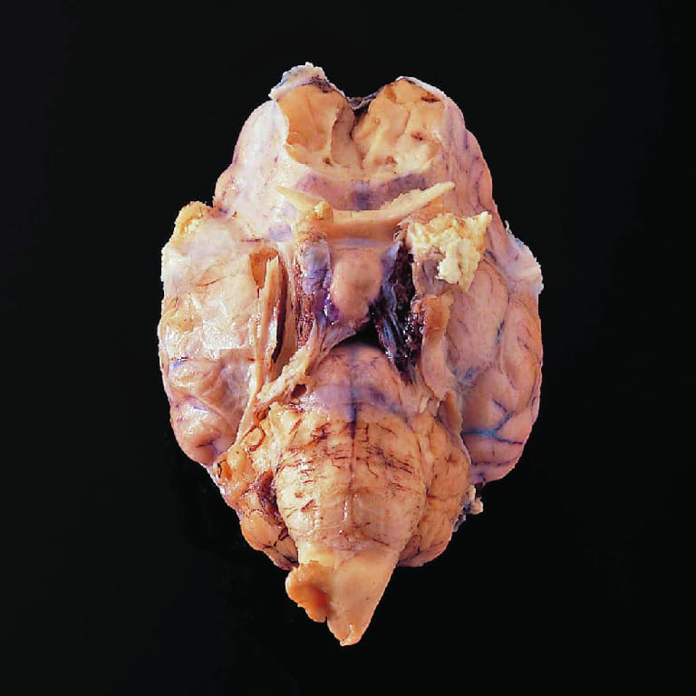 Sheep Brain with Dura Mater