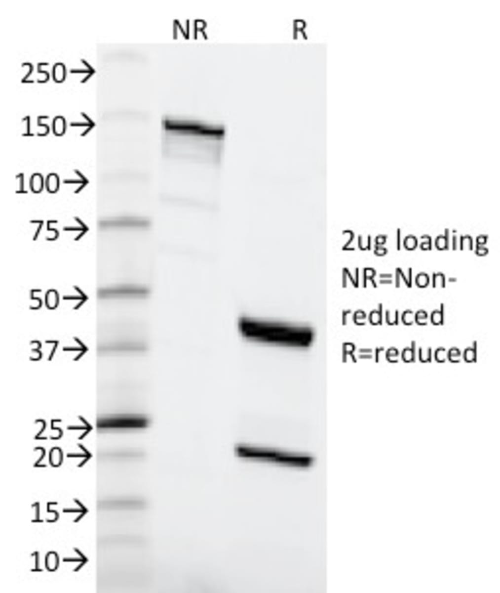 Anti-MSH6 Mouse Monoclonal Antibody [clone: MSH6/2111] | VWR, part of ...