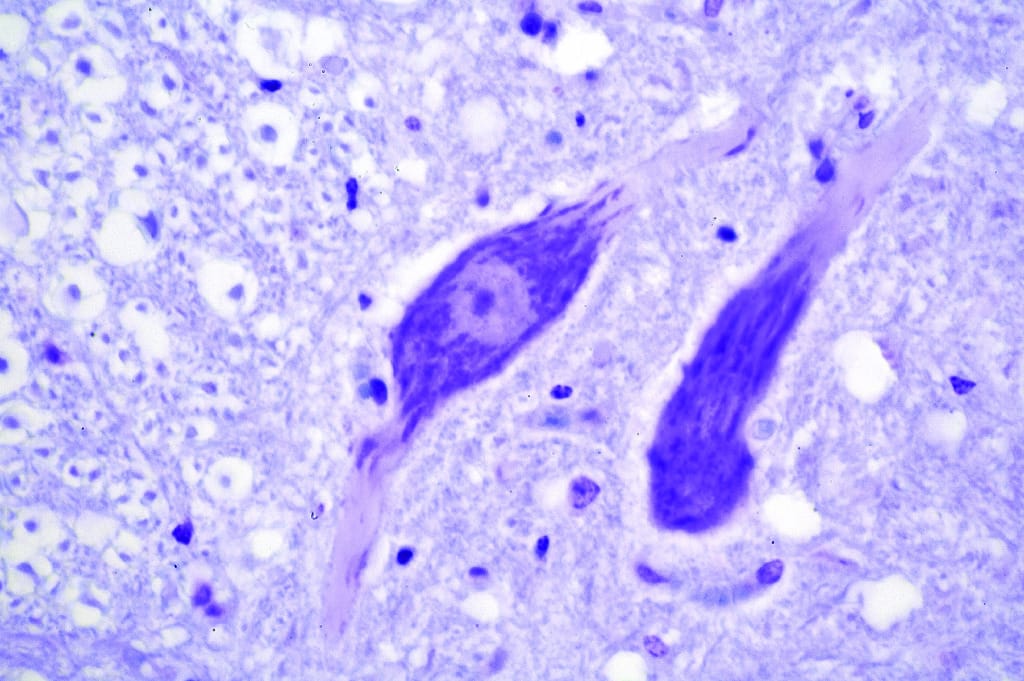 Ribosomes, Nissl Bodies Slide