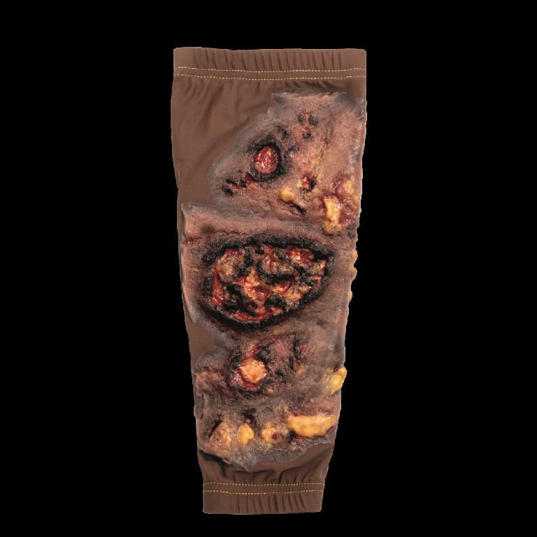 STOPS® Wound Clothing