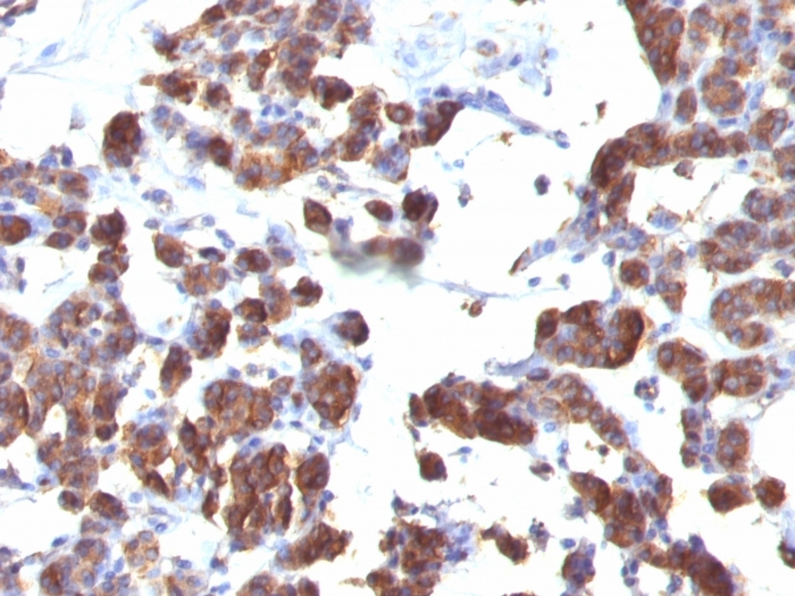 Anti-Thyroglobulin Mouse Monoclonal Antibody [clone: TGB04 + TGB05 ...