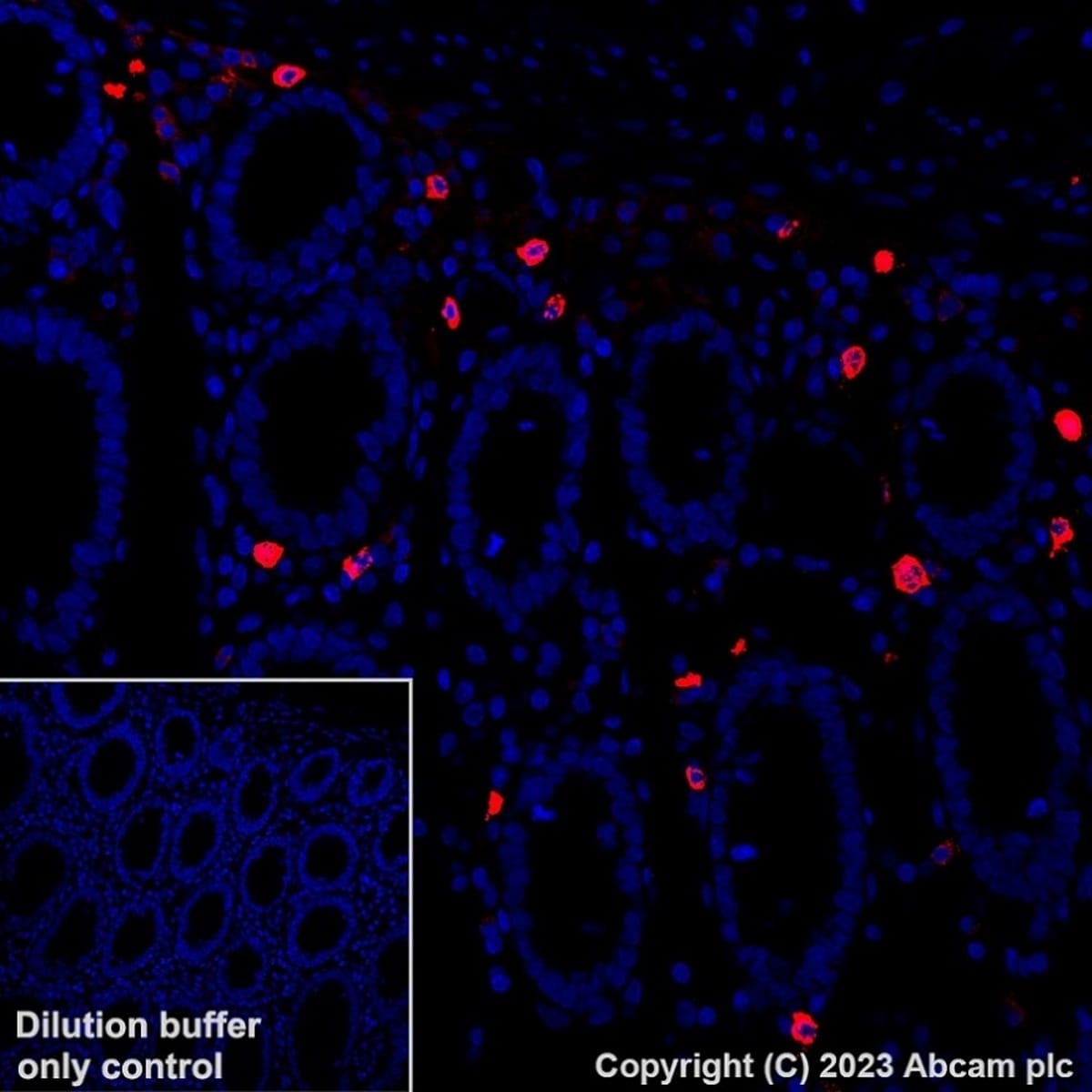 Anti-Mast Cell Tryptase Rabbit Monoclonal Antibody [clone: EPR9522 ...