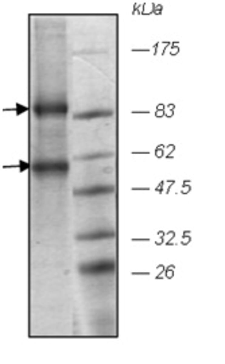 Human Recombinant EZH2 + EED (from Baculovirus (Sf9 Insect cells ...