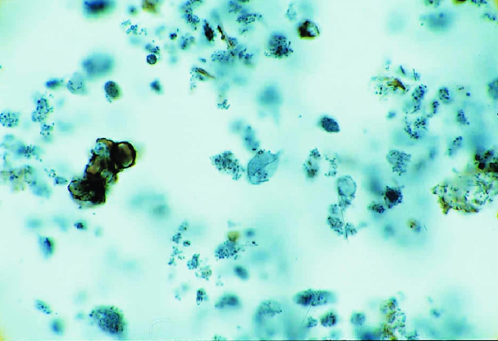 Giardia lamblia, Trophozoites Slide