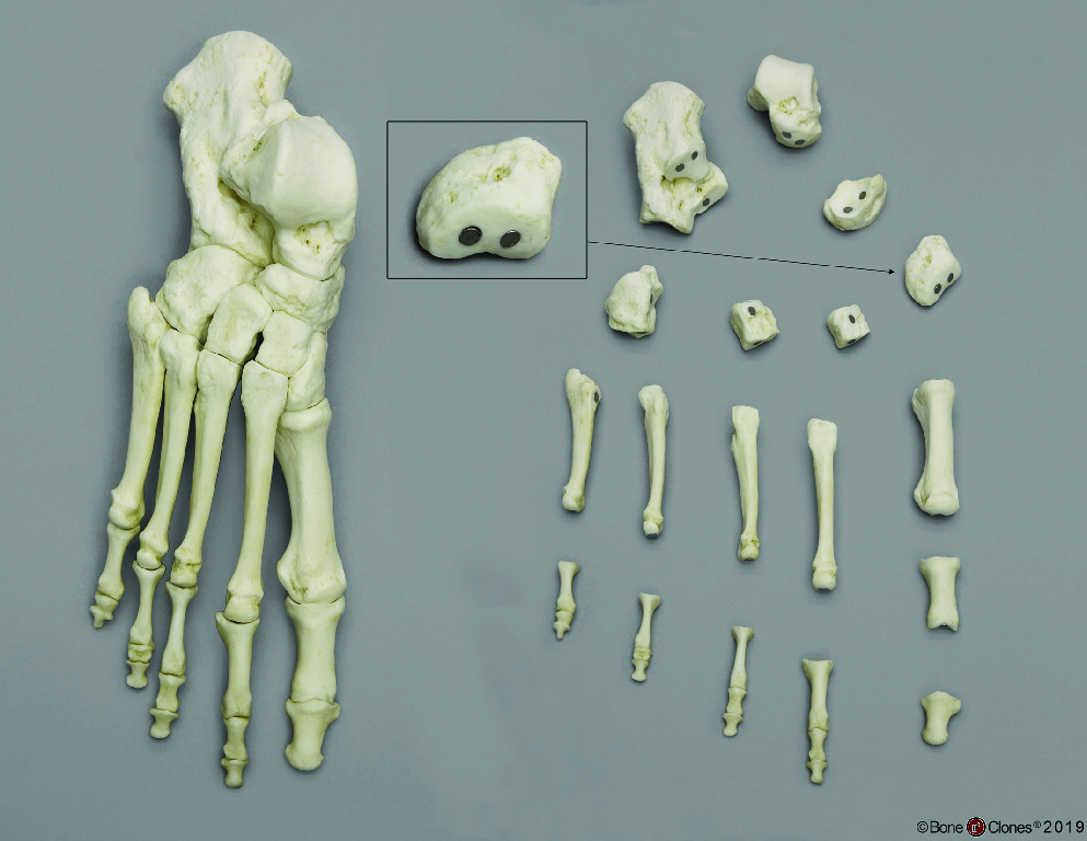 BoneClones® Magnetic Hand and Foot