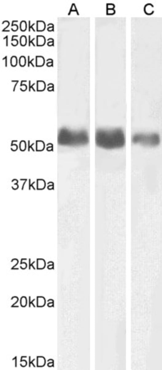Anti-Alkaline Phosphatase, Non Tissue-Specific Goat Polyclonal Antibody ...