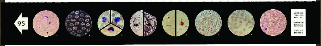 Human Blood Microslides