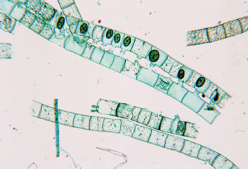 Spirogyra, Scalariform Conjugation Slide